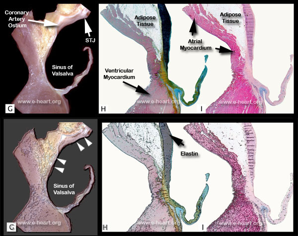 Ao Valve  Histology